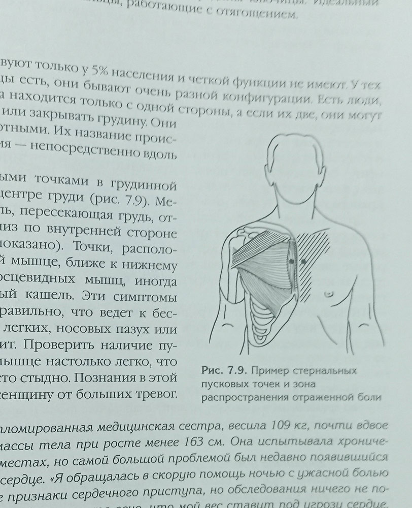 Эксмо Синдром замороженного плеча. Терапия триггерных точек для